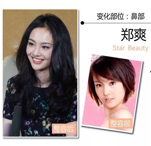 明星整容去哪里,探寻全球热门整形目的地